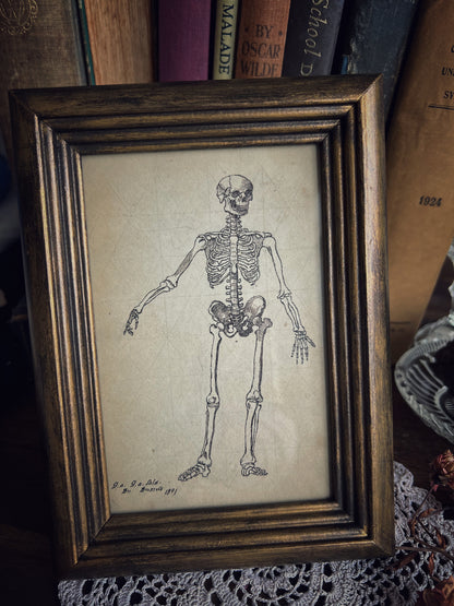 Framed Skeleton Print
