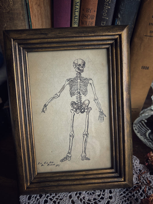 Framed Skeleton Print