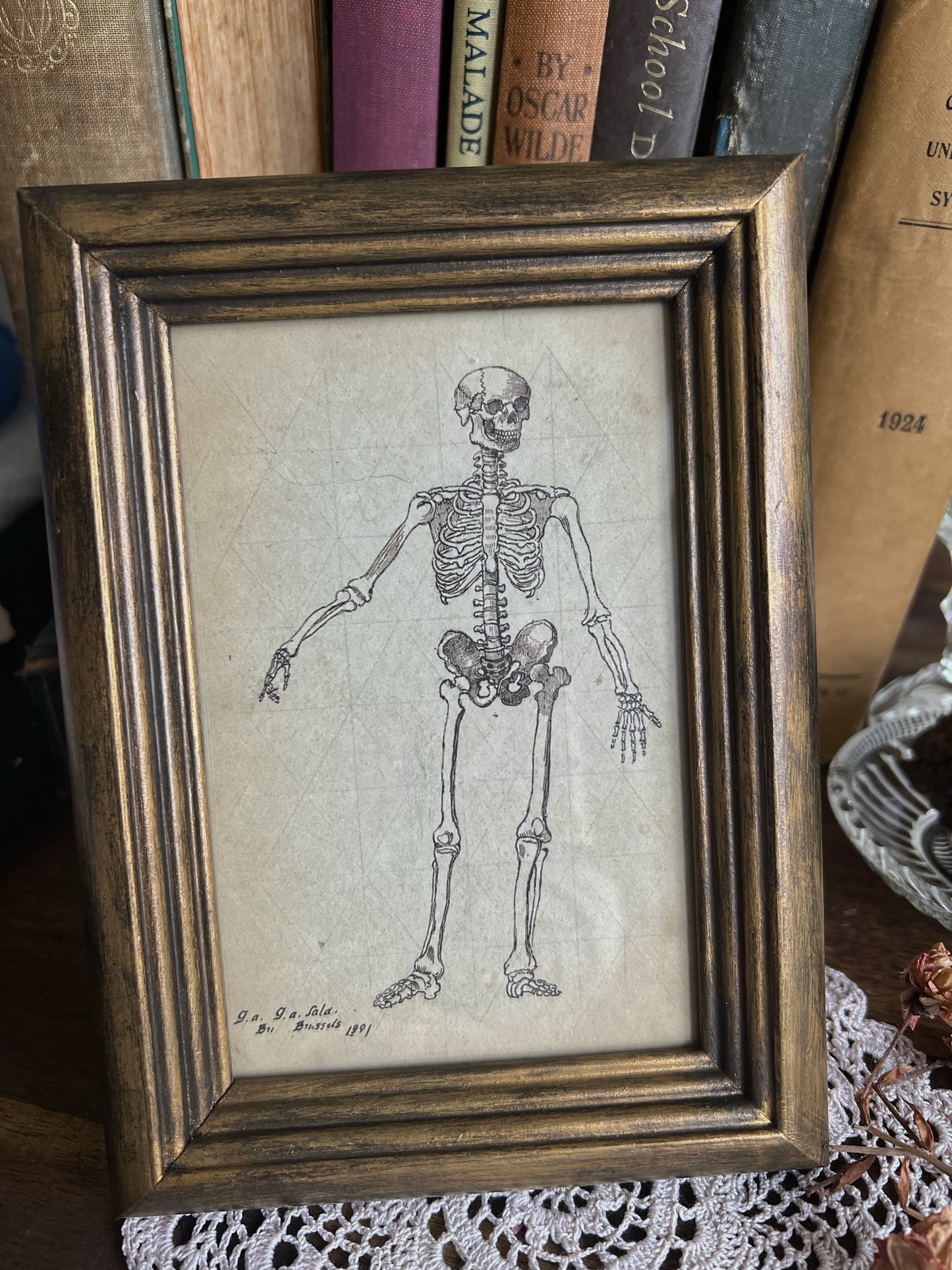 Framed Skeleton Print