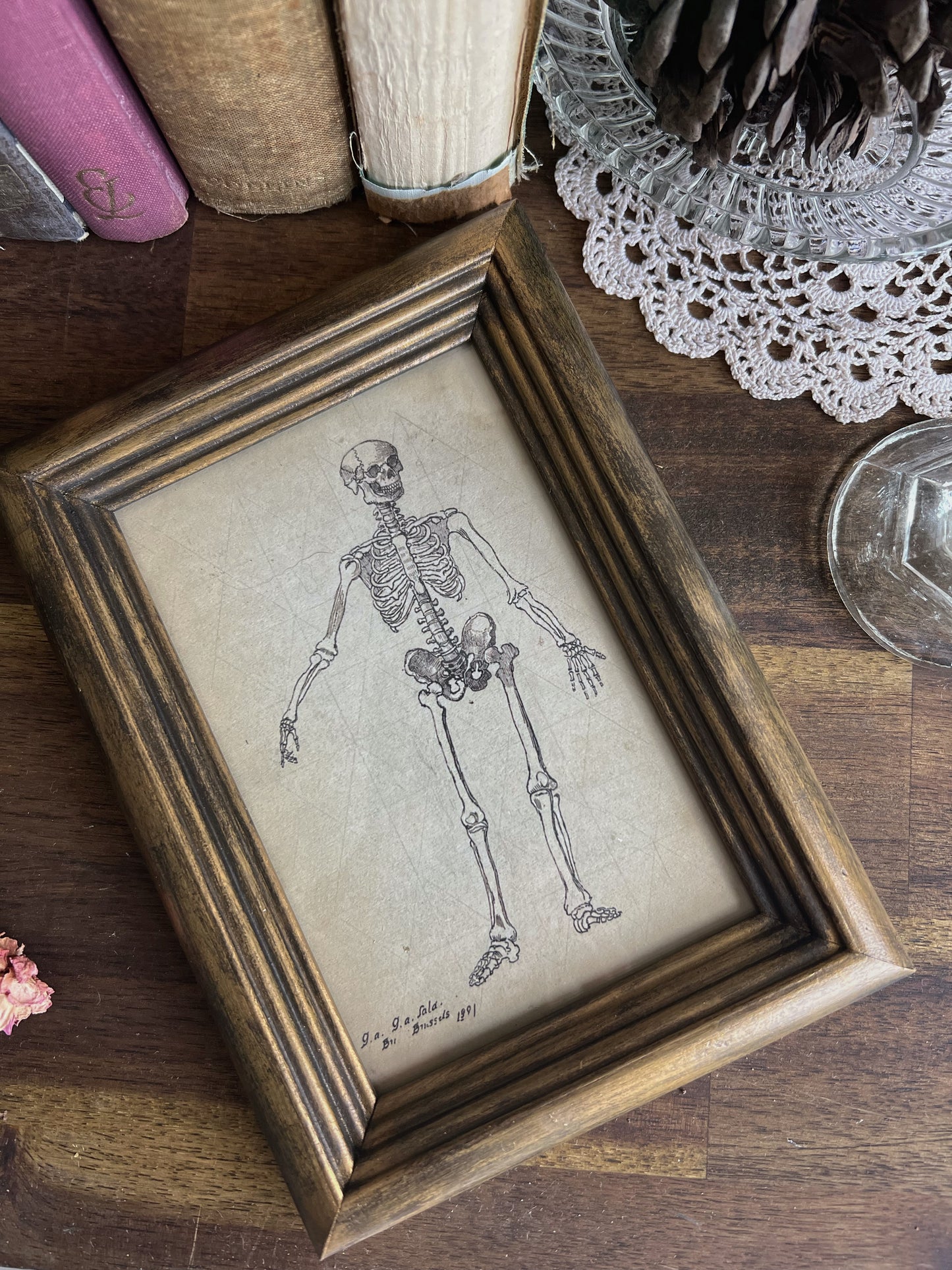 Framed Skeleton Print