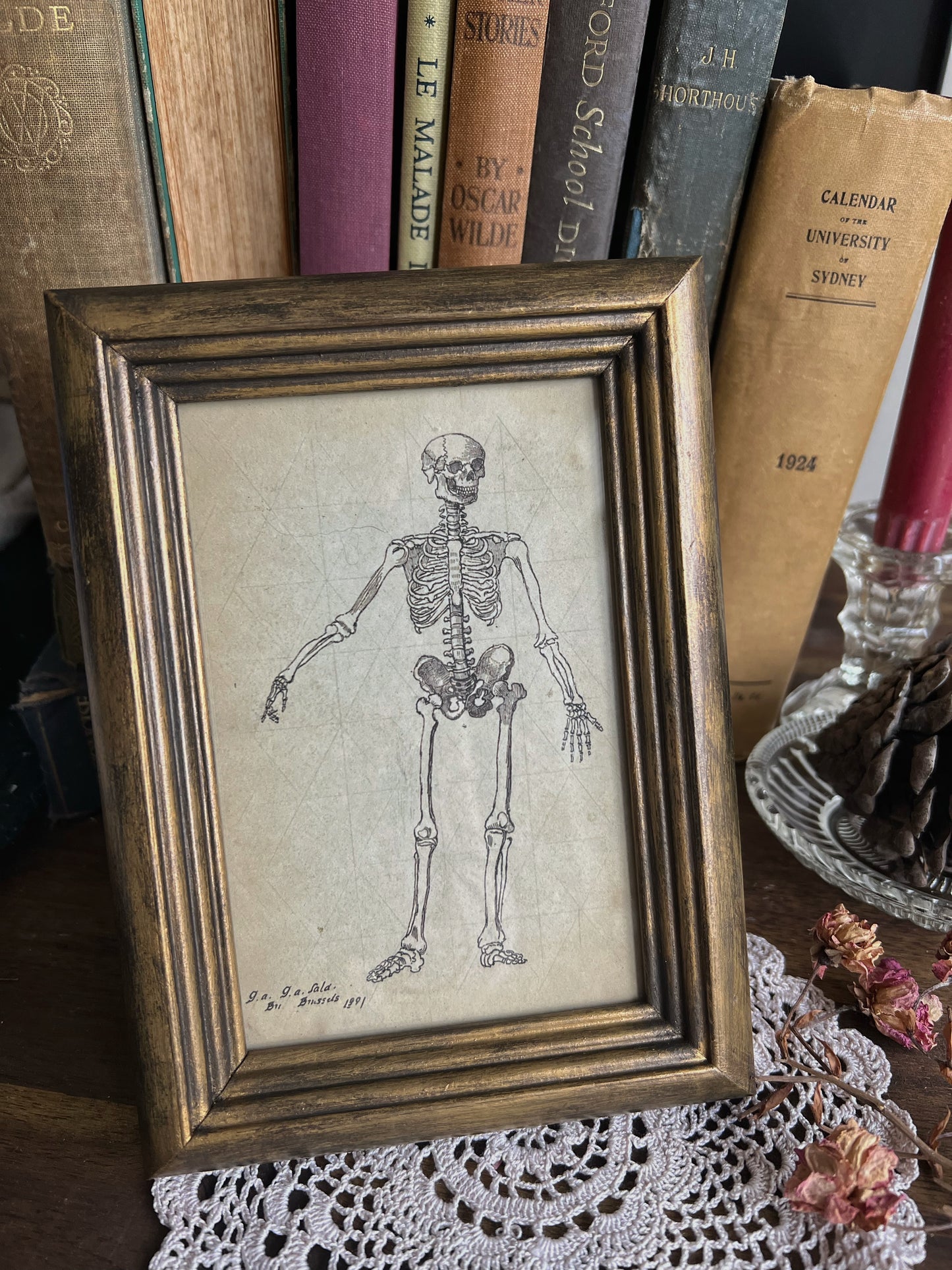 Framed Skeleton Print